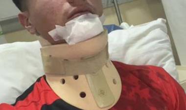 Jugador de Reserva de Sporting internado en el Penna tras ser agredido por sus pares de Villa Mitre