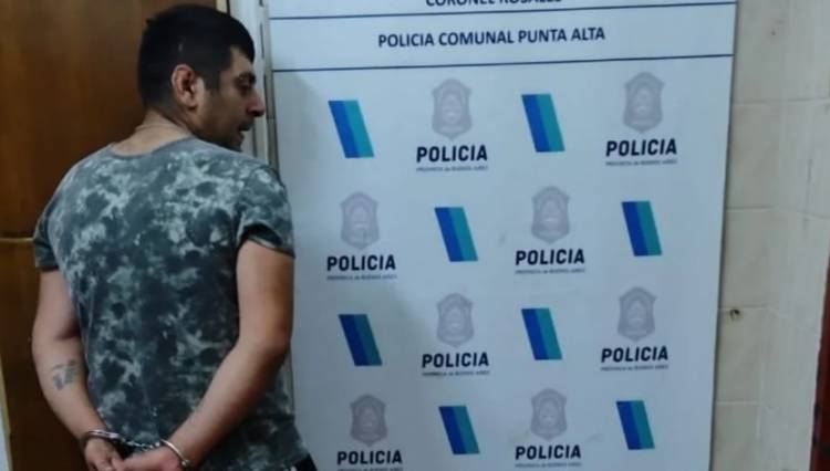 Detuvieron a un hombre acusado de golpear y provocarle un hematoma a su pareja